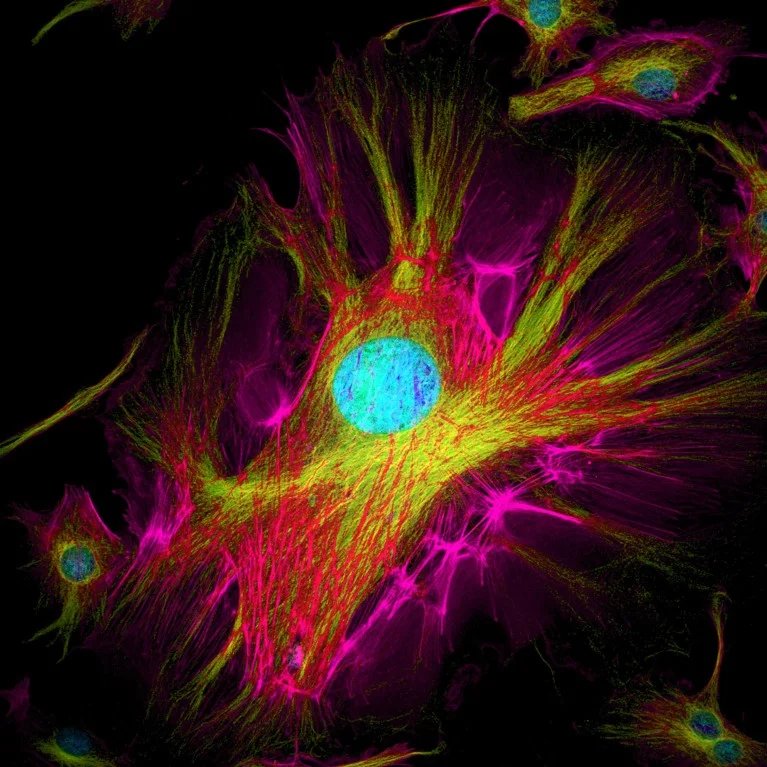 Confocal light micrograph of cultured endothelial cells, with fluorescent dyes added to show cell structures.
